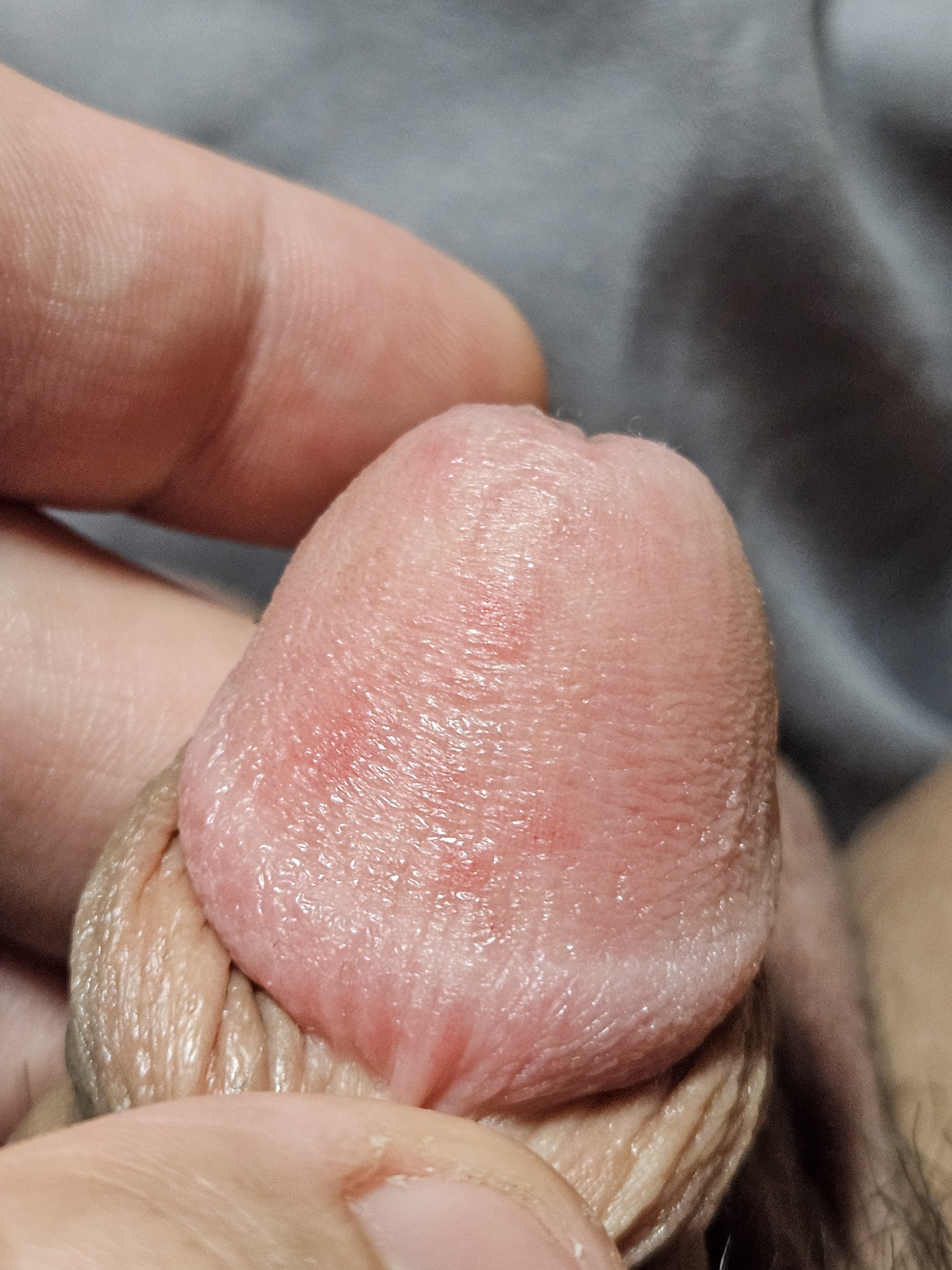 125789-cf0c36b3e47b.jpg