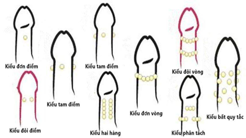 133579-fe34ba1d2be2.jpg