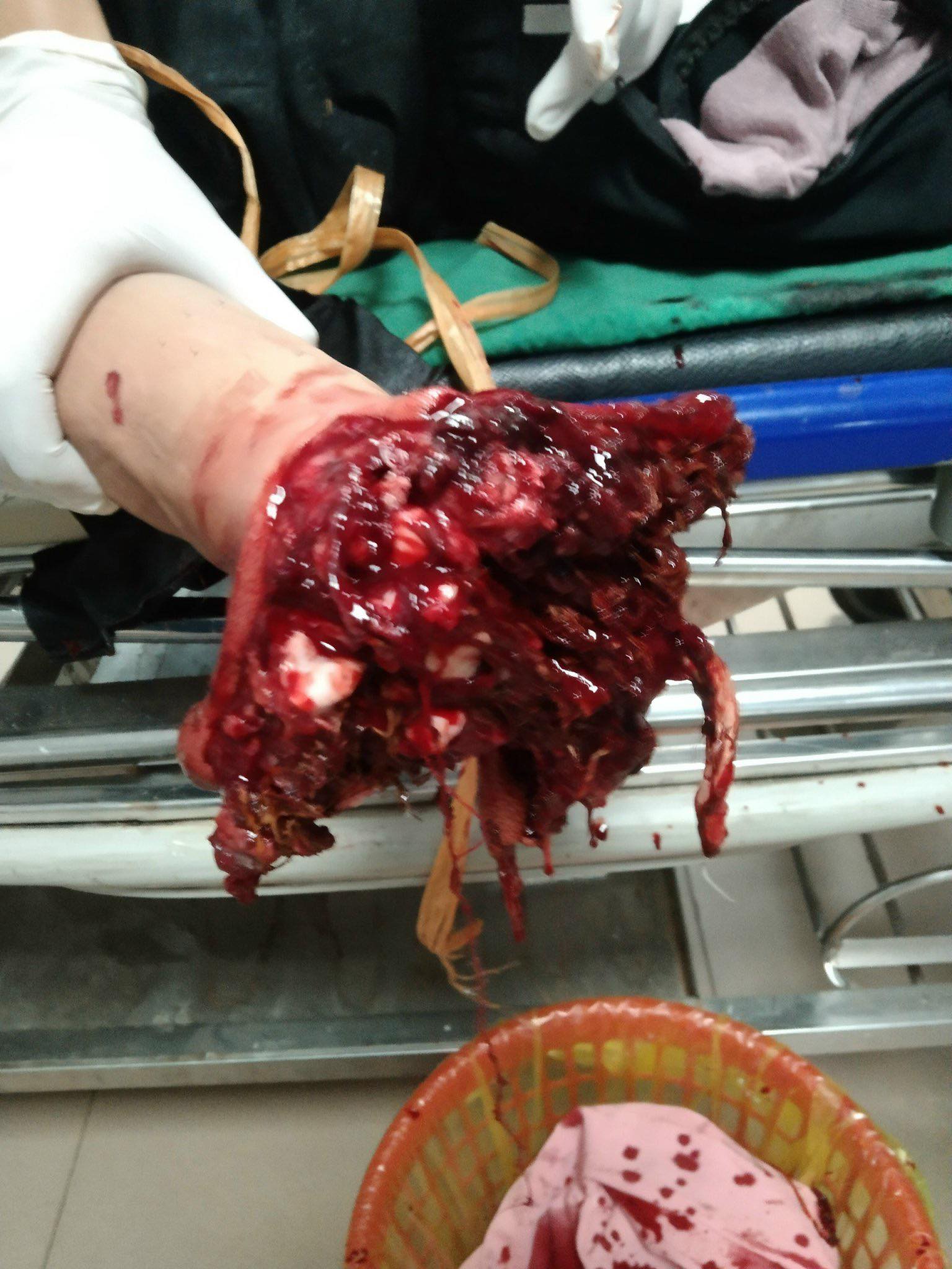 139268-de3dca1b17fb.jpeg