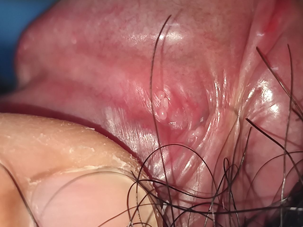 169505-6d9a1e6ab50a.jpg