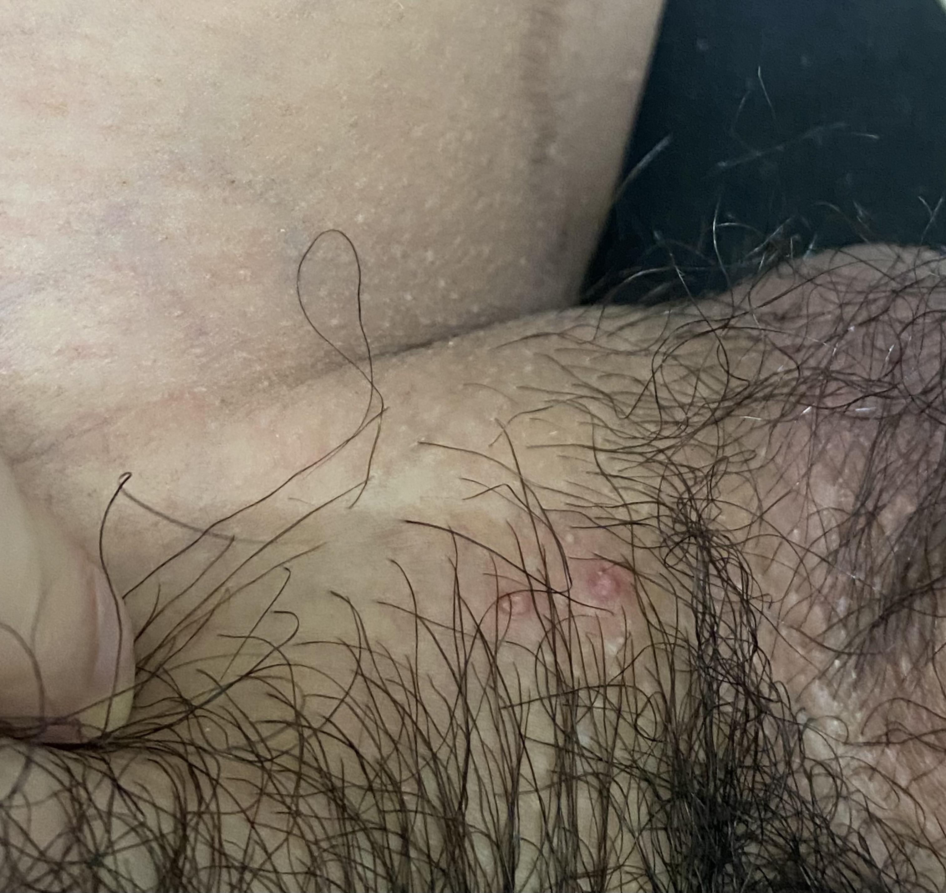 17018-323166acaa32.jpeg