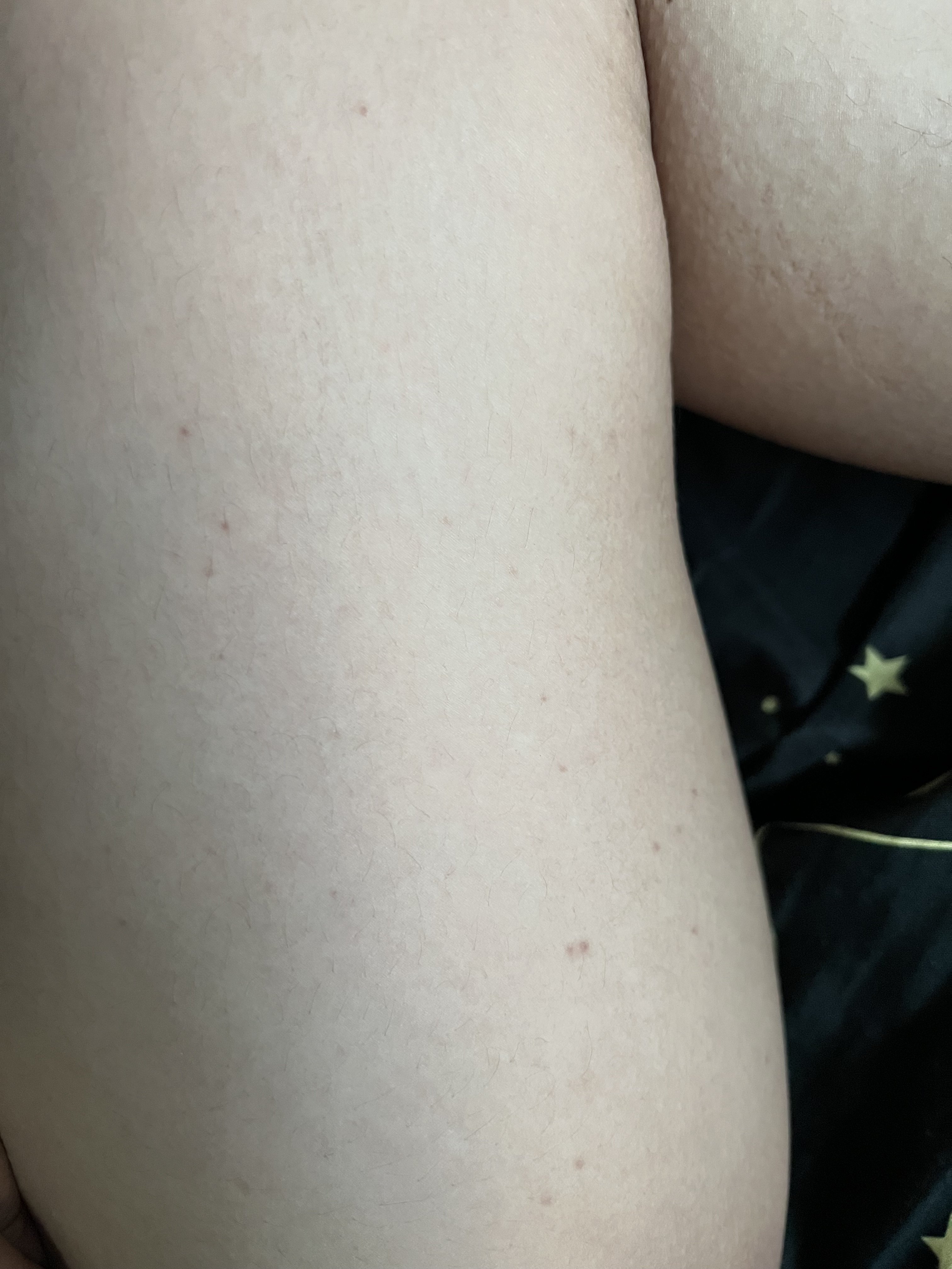 197403-1746516bed52.jpeg