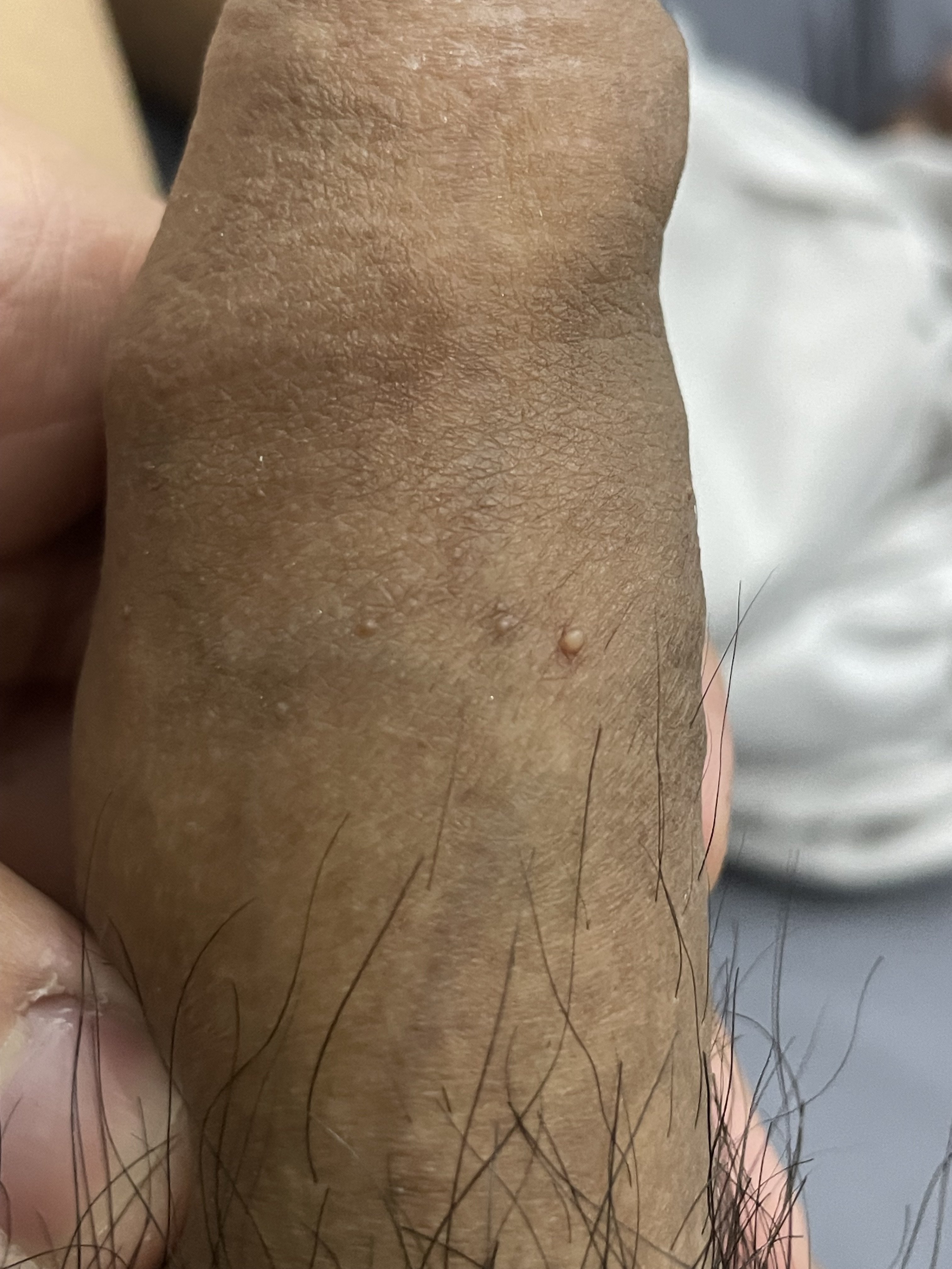 198366-ffc24055fda8.jpeg