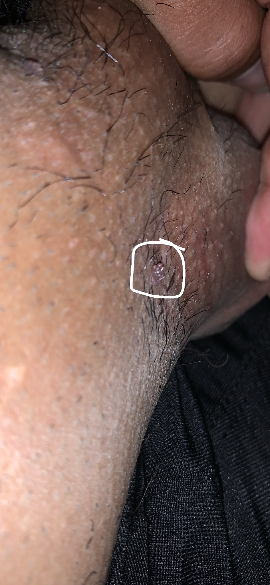 204239-ca63cf76bd72.jpeg