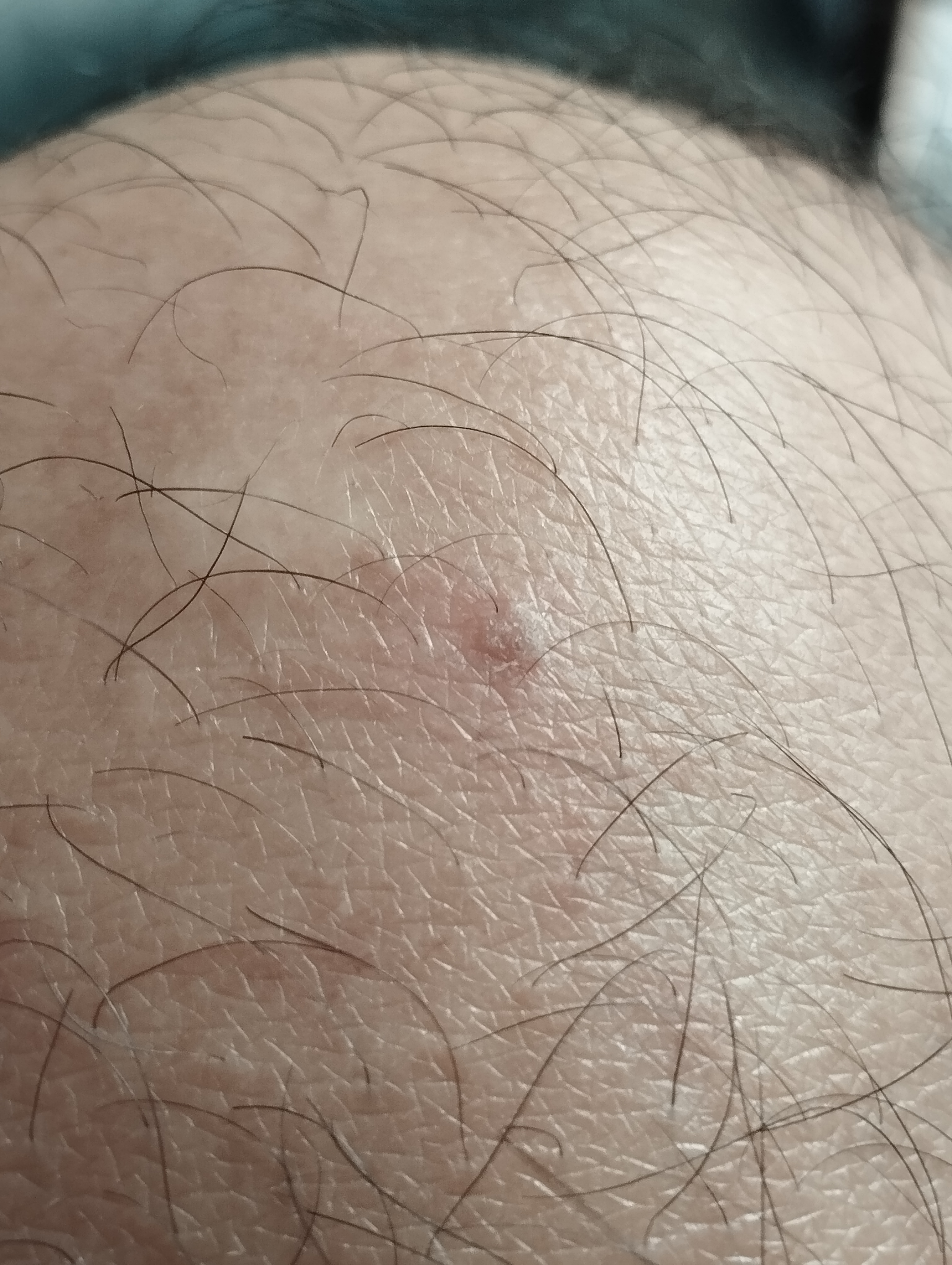 266226-c013458cf0d2.jpg