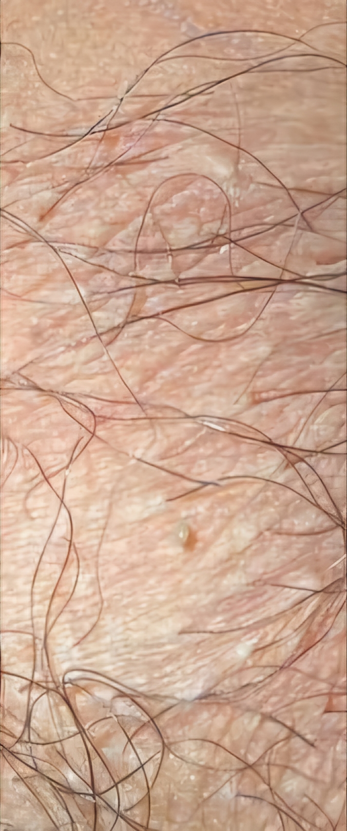 288906-bd71f62e398f.jpg