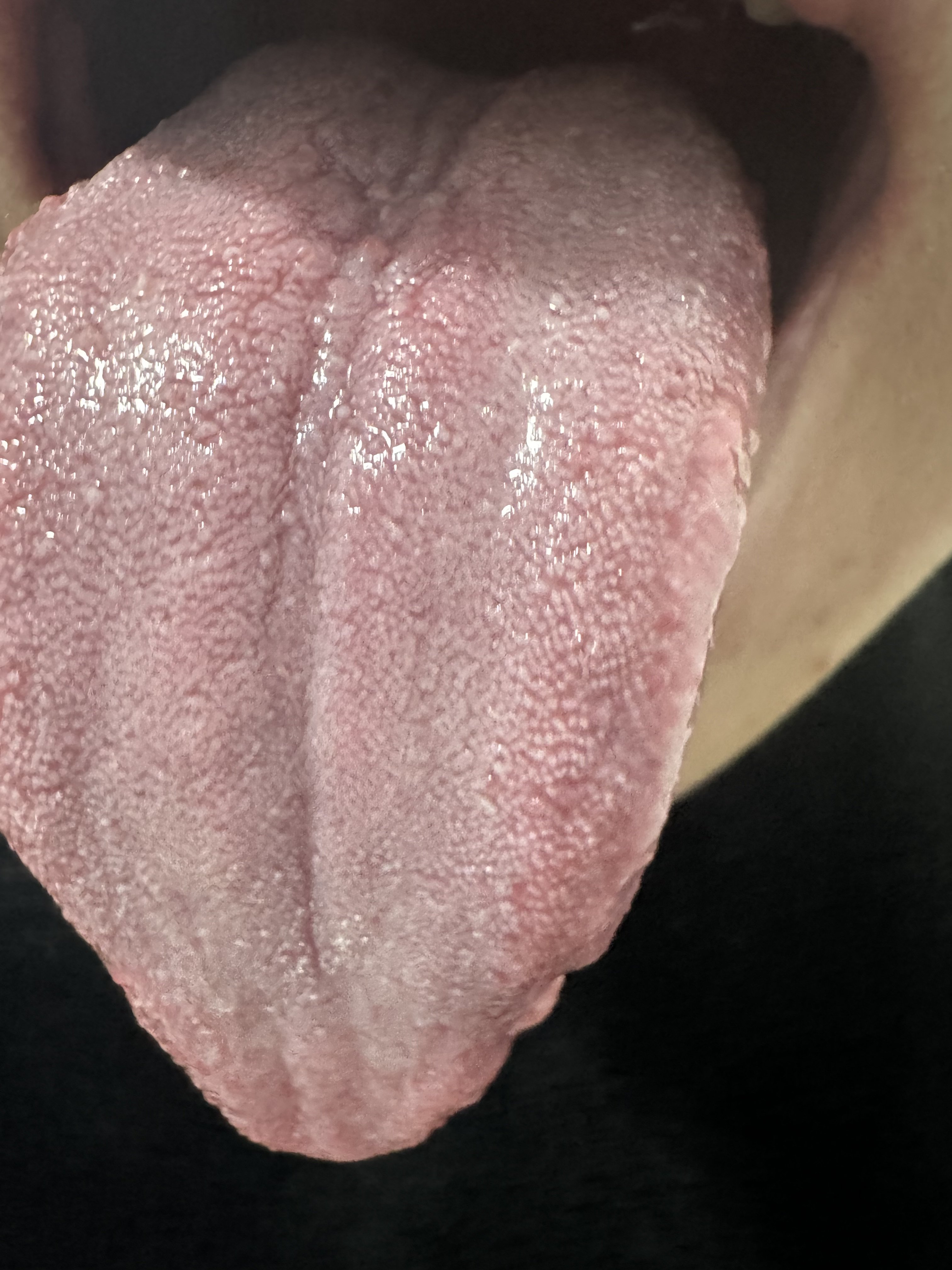 313713-156cf190e52a.jpeg