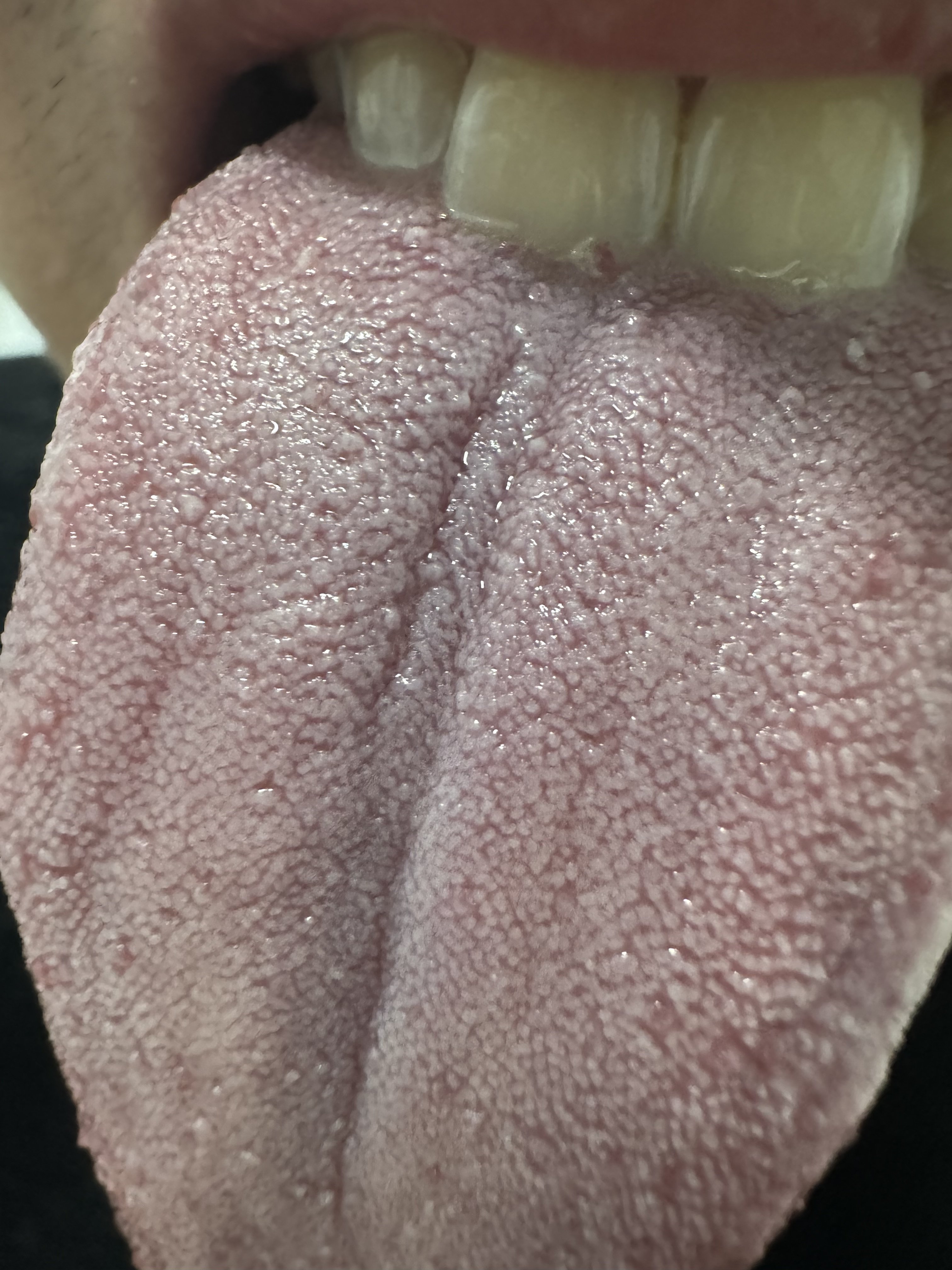 313715-16a060cd5f0a.jpeg
