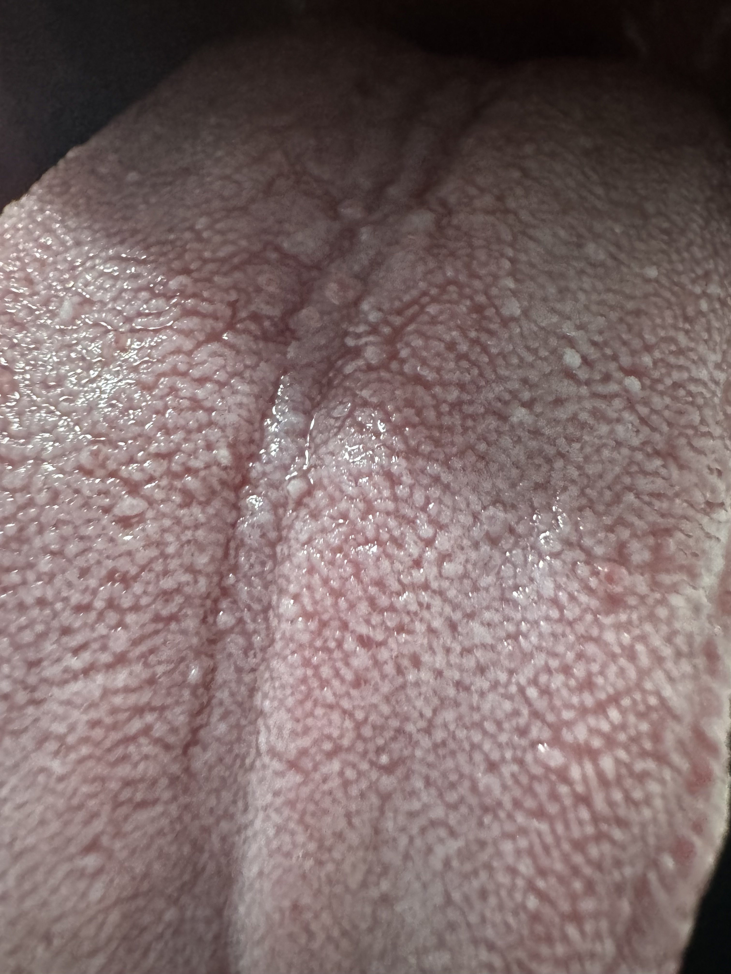 313716-8f337cf8919e.jpeg