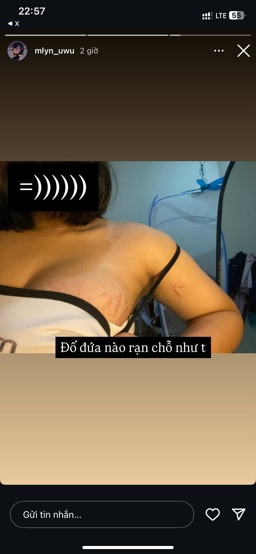 337539-e0656dfdc39a.png