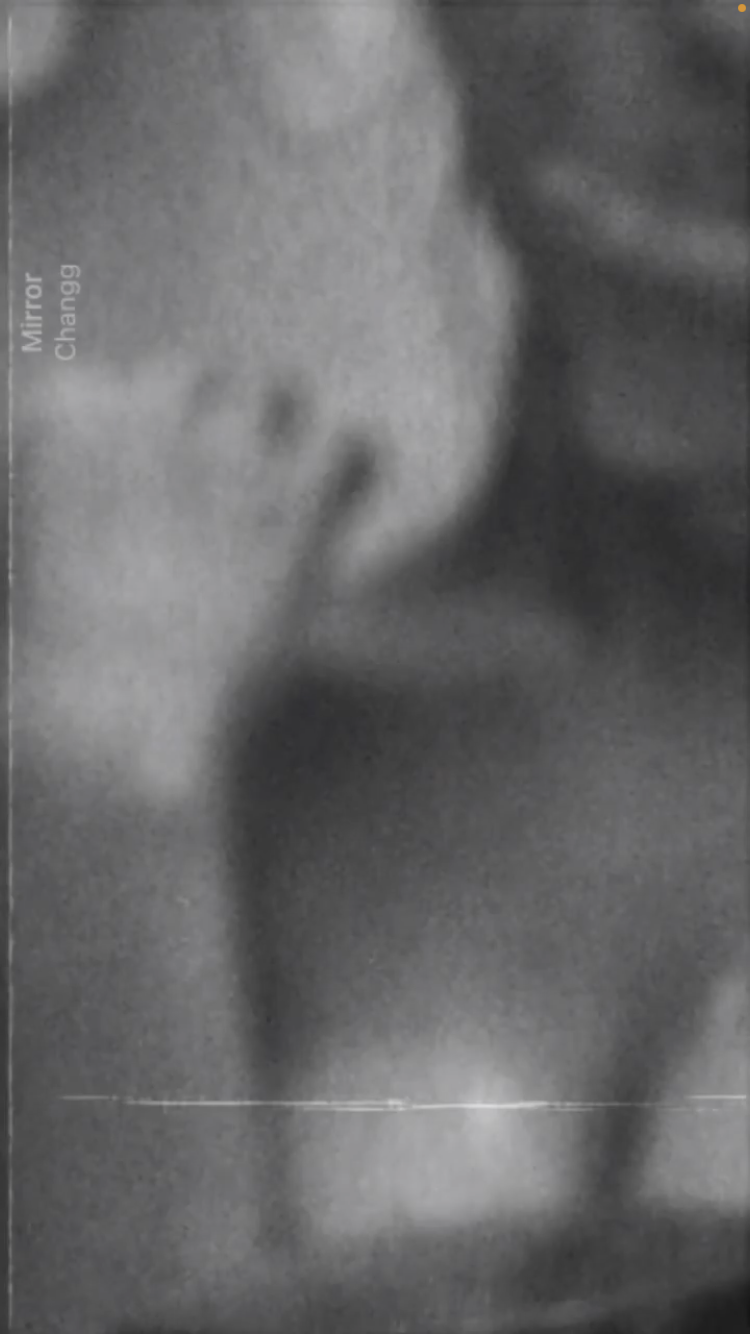 351488-0fad406ed37d.png