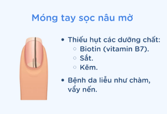 368819-5066f89765e1.png