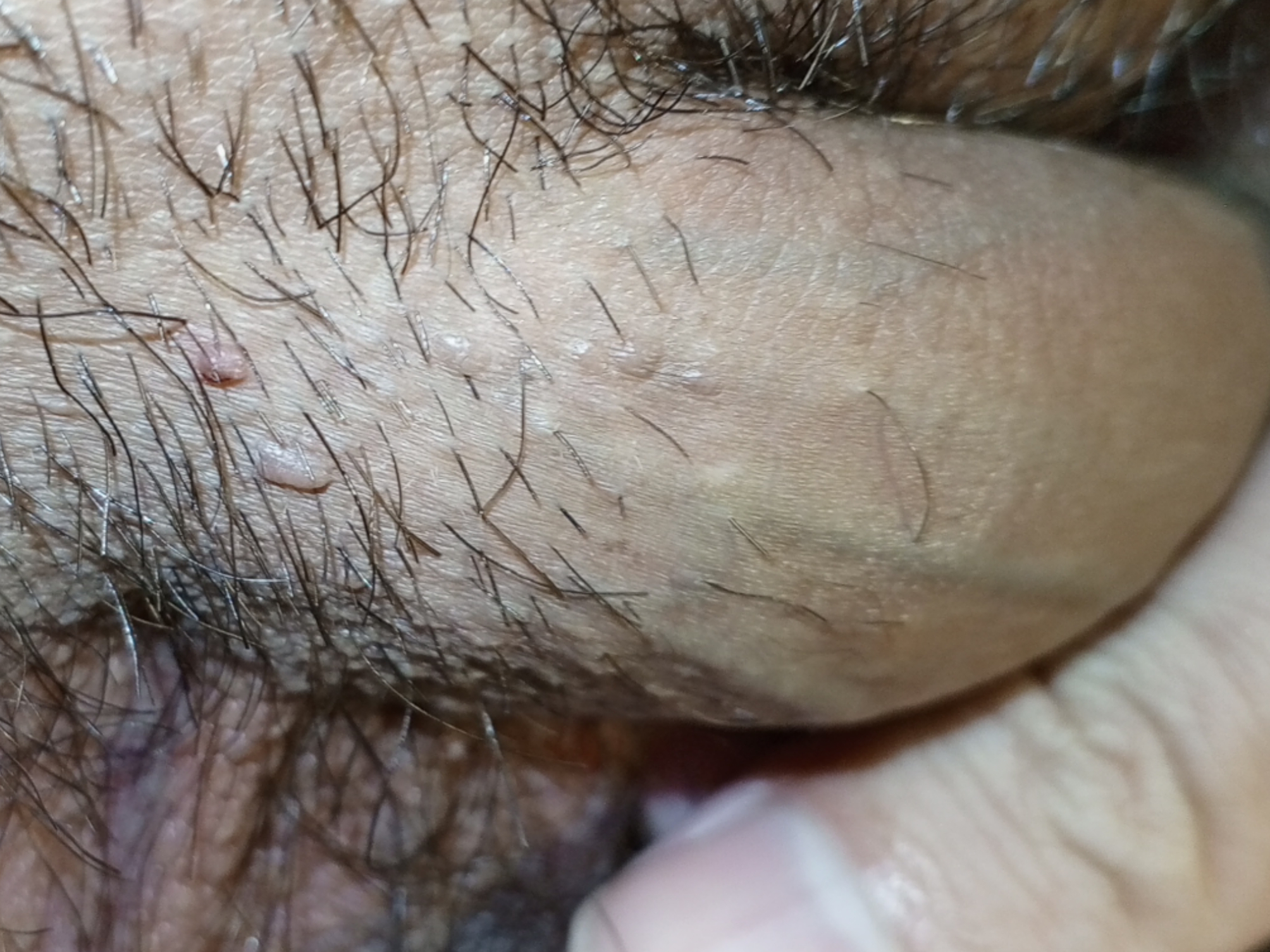 395507-104f91d676ae.jpg