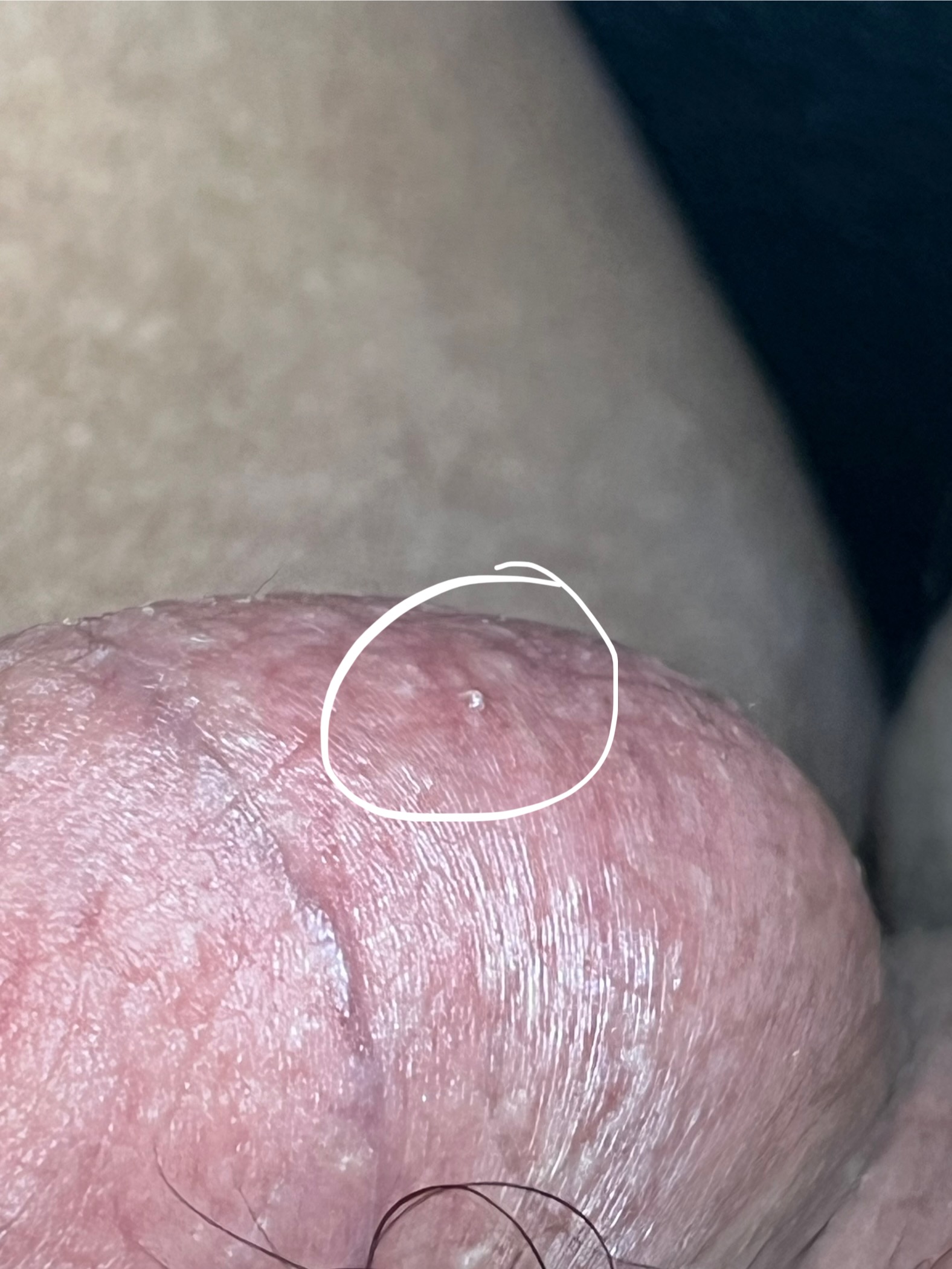 429586-2cea68cc2e80.jpeg