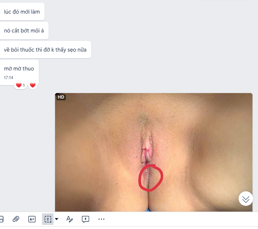 472912-f5da73a2dbc2.png