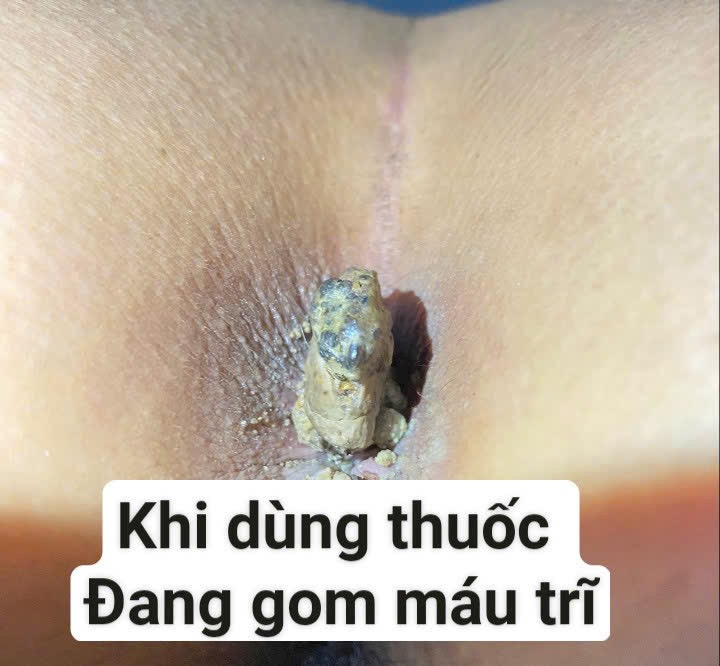 503658-ebcf3269c35d.jpeg